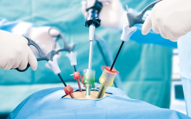 Laparoscopic Diagnostic Surgery